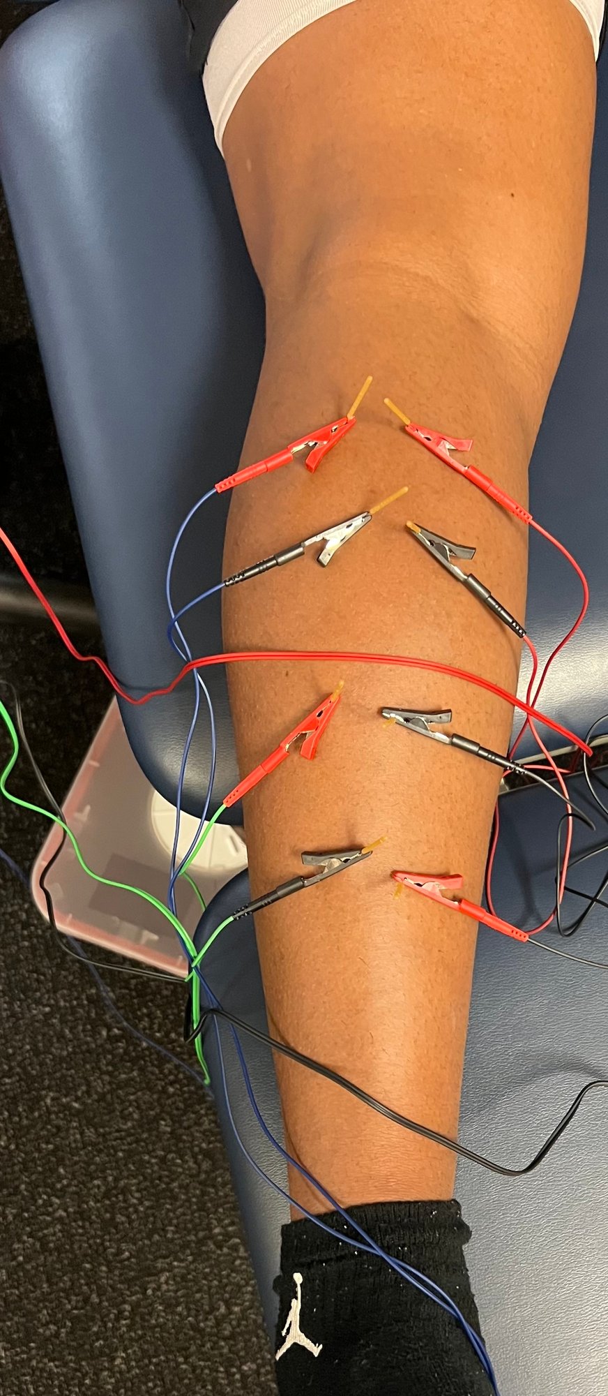 dry-needling-englewood-co